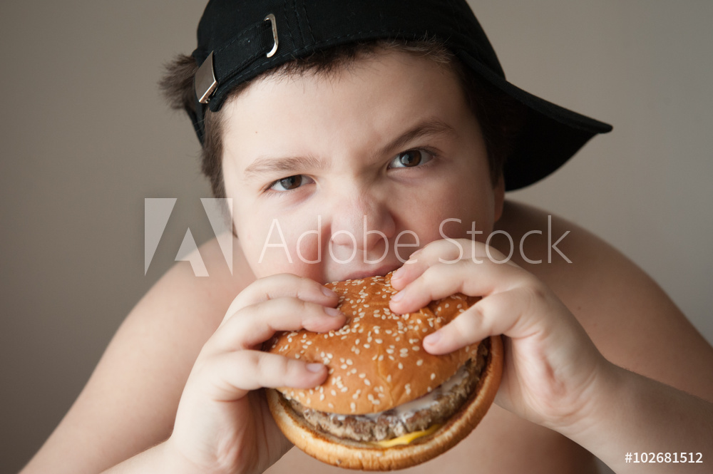 Causes of Childhood Obesity